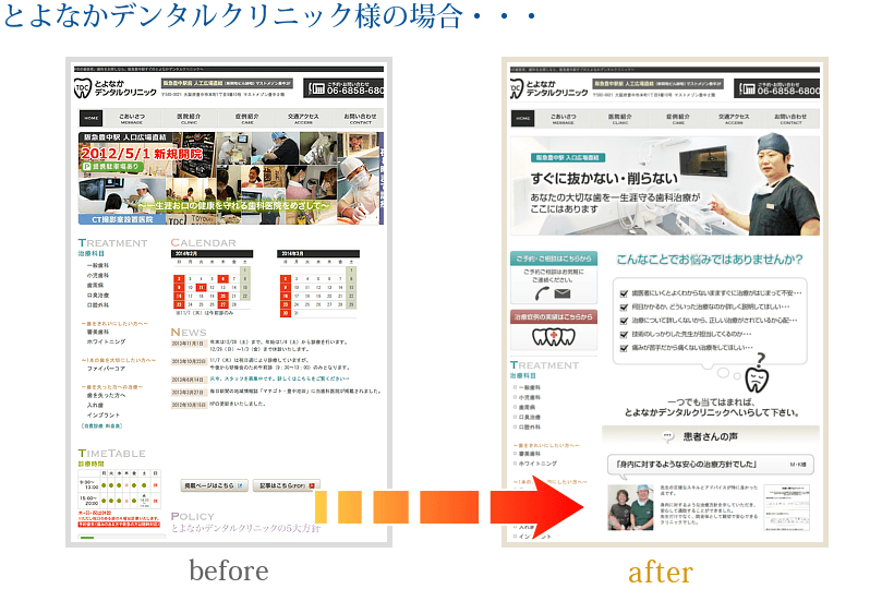 とよなかデンタルクリニック様の場合・・・